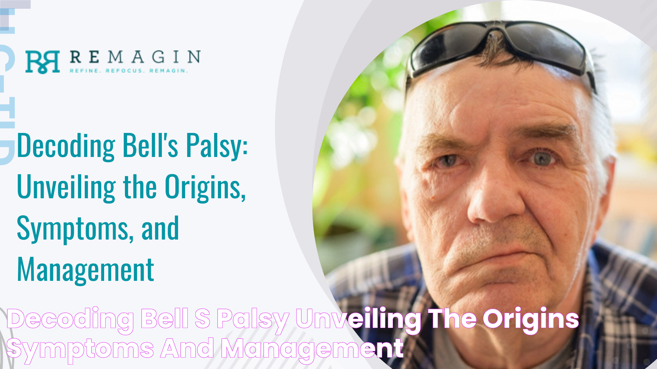 Inspirational Stories Of Celebrities With Bell's Palsy