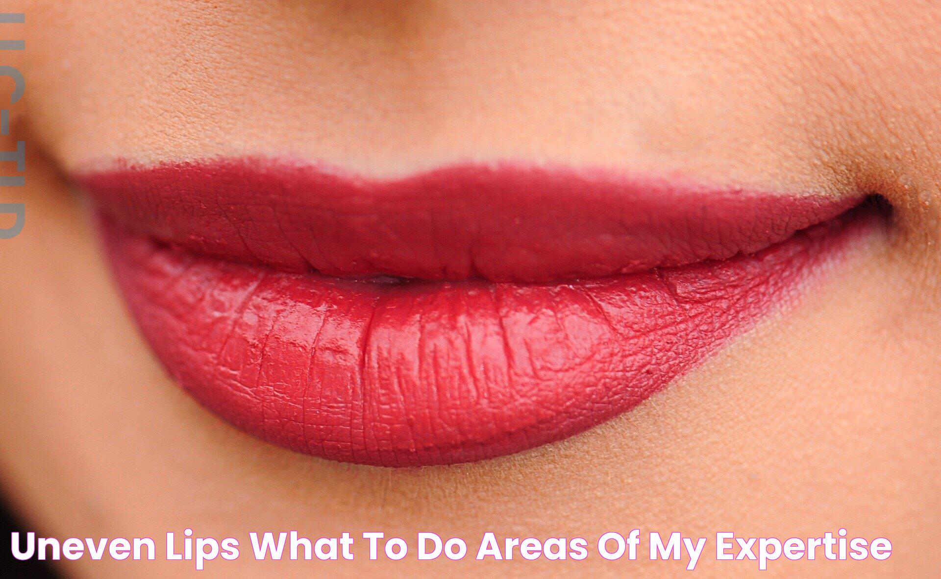 Understanding The Causes And Solutions For Lips Uneven