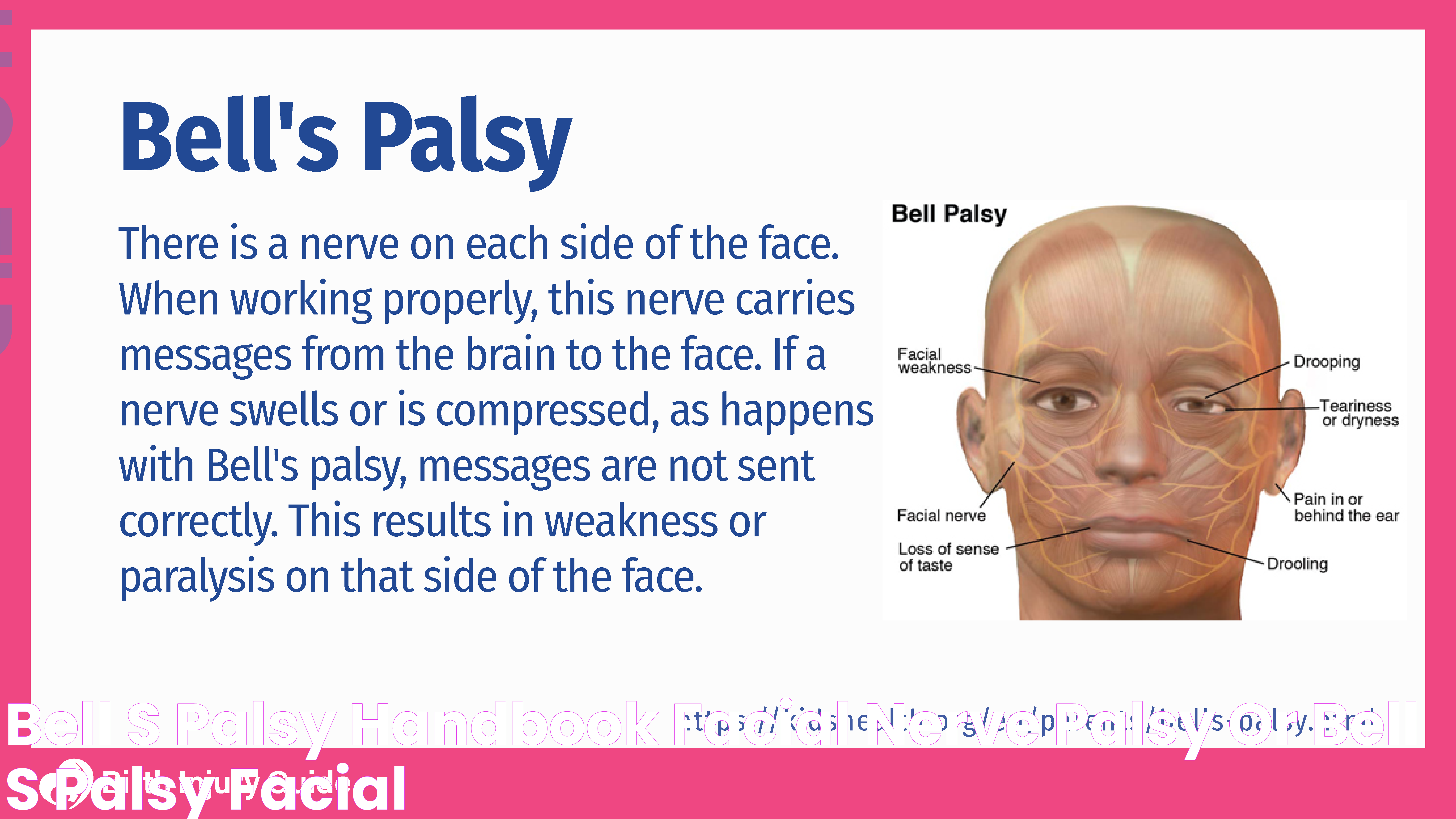 Bell's Palsy Handbook Facial Nerve Palsy Or Bell's Palsy Facial