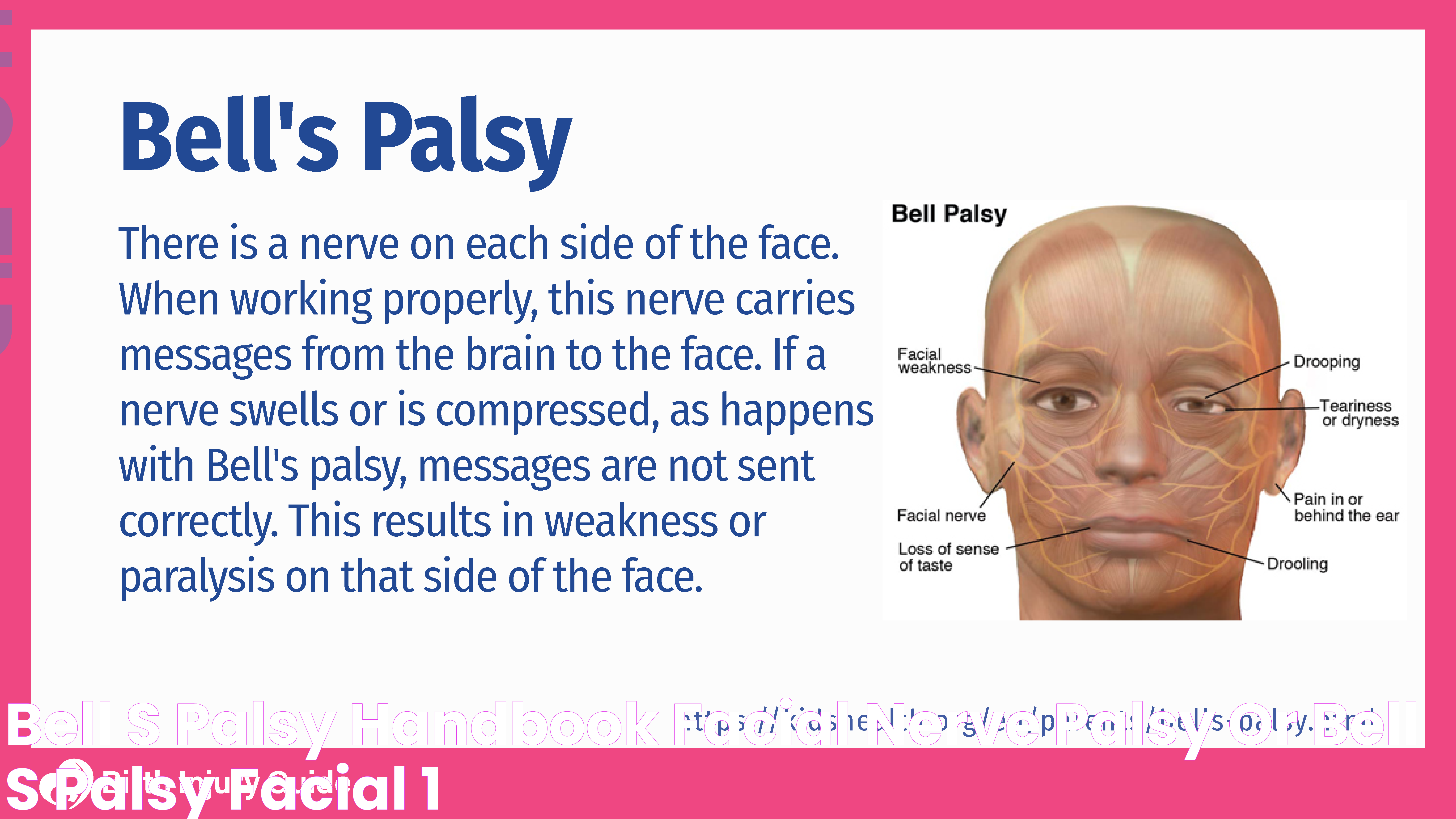 Bell's Palsy Handbook Facial Nerve Palsy Or Bell's Palsy Facial