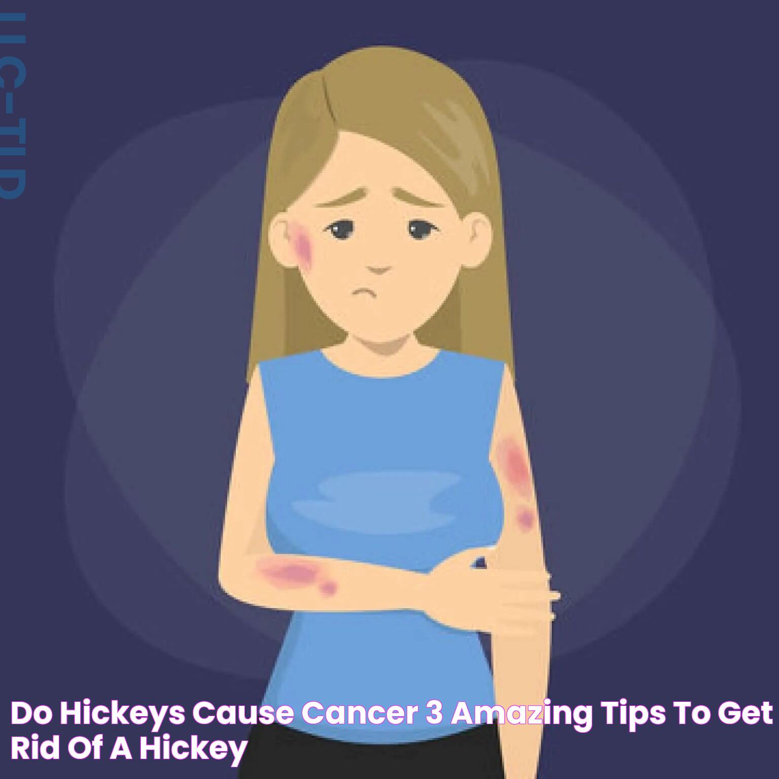 Do Hickeys Cause Cancer: Myth Or Reality?