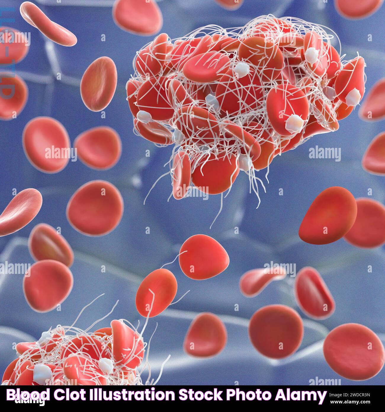 Blood clot, illustration Stock Photo Alamy