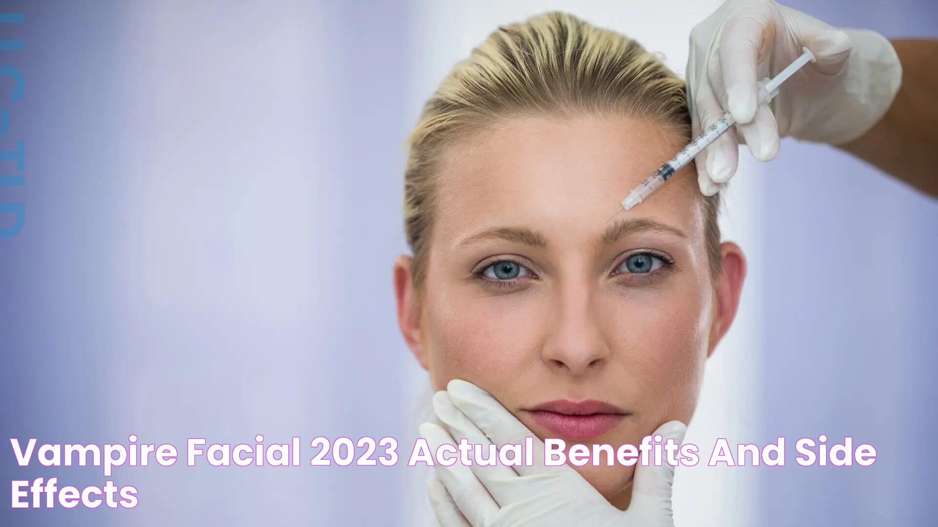 VAMPIRE FACIAL® 2023 Actual Benefits and Side Effects