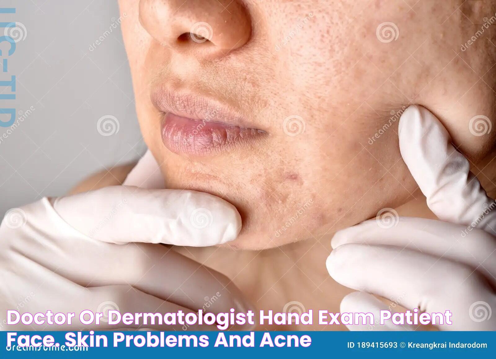 Doctor or Dermatologist Hand Exam Patient Face. Skin Problems and Acne