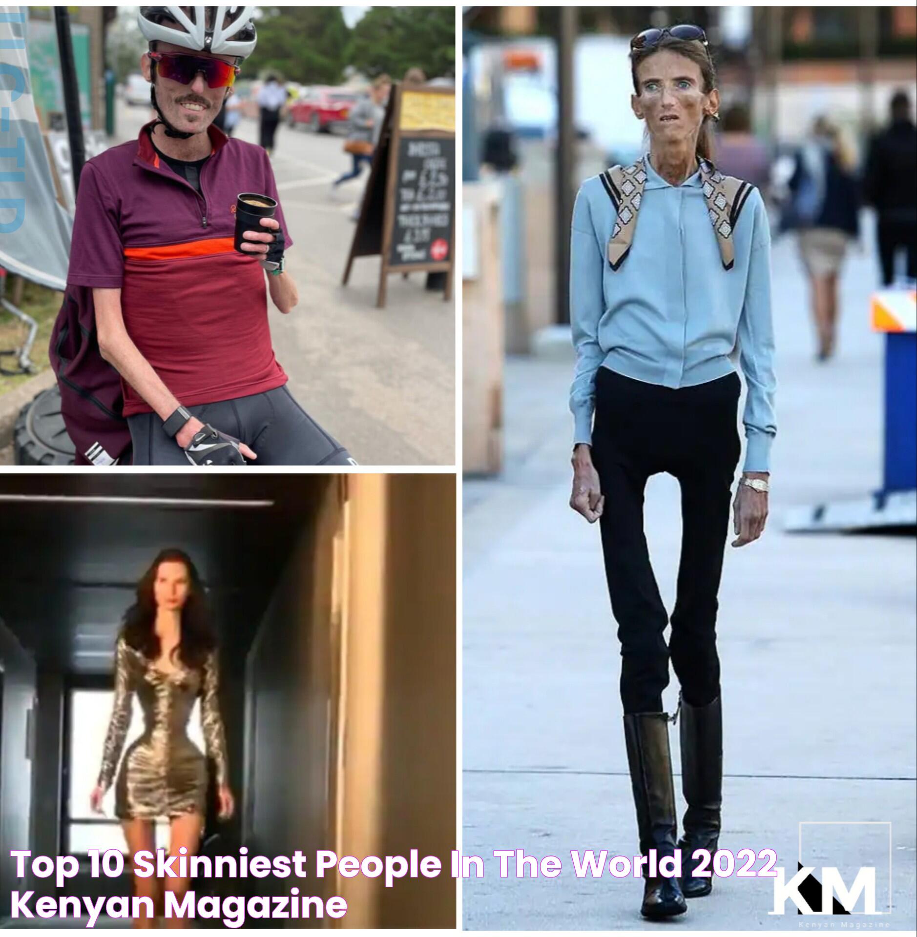 Meet The Skinniest Person In The World: Life, Challenges, And Triumphs