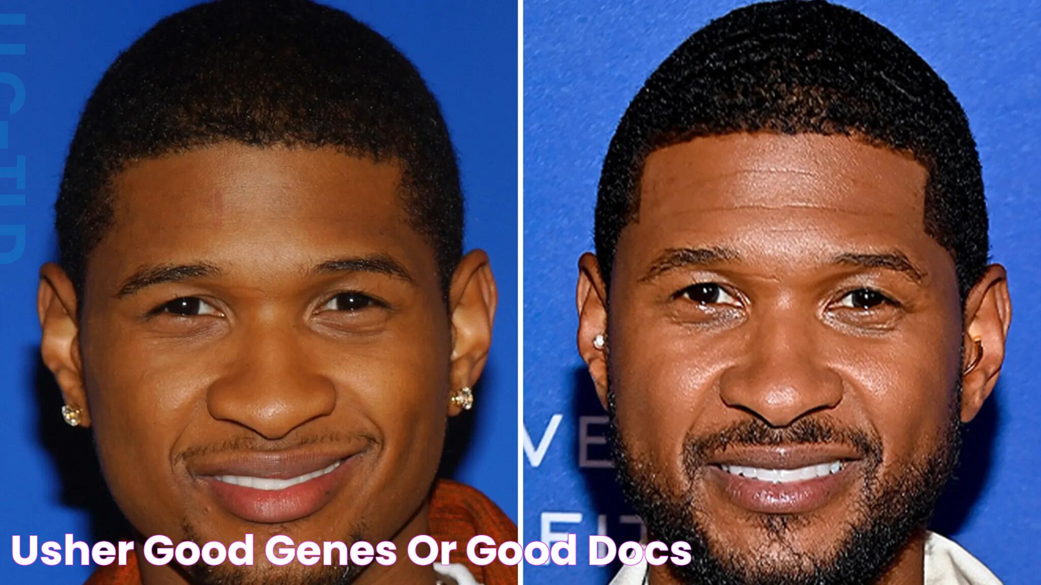 Usher Good Genes Or Good Docs?!