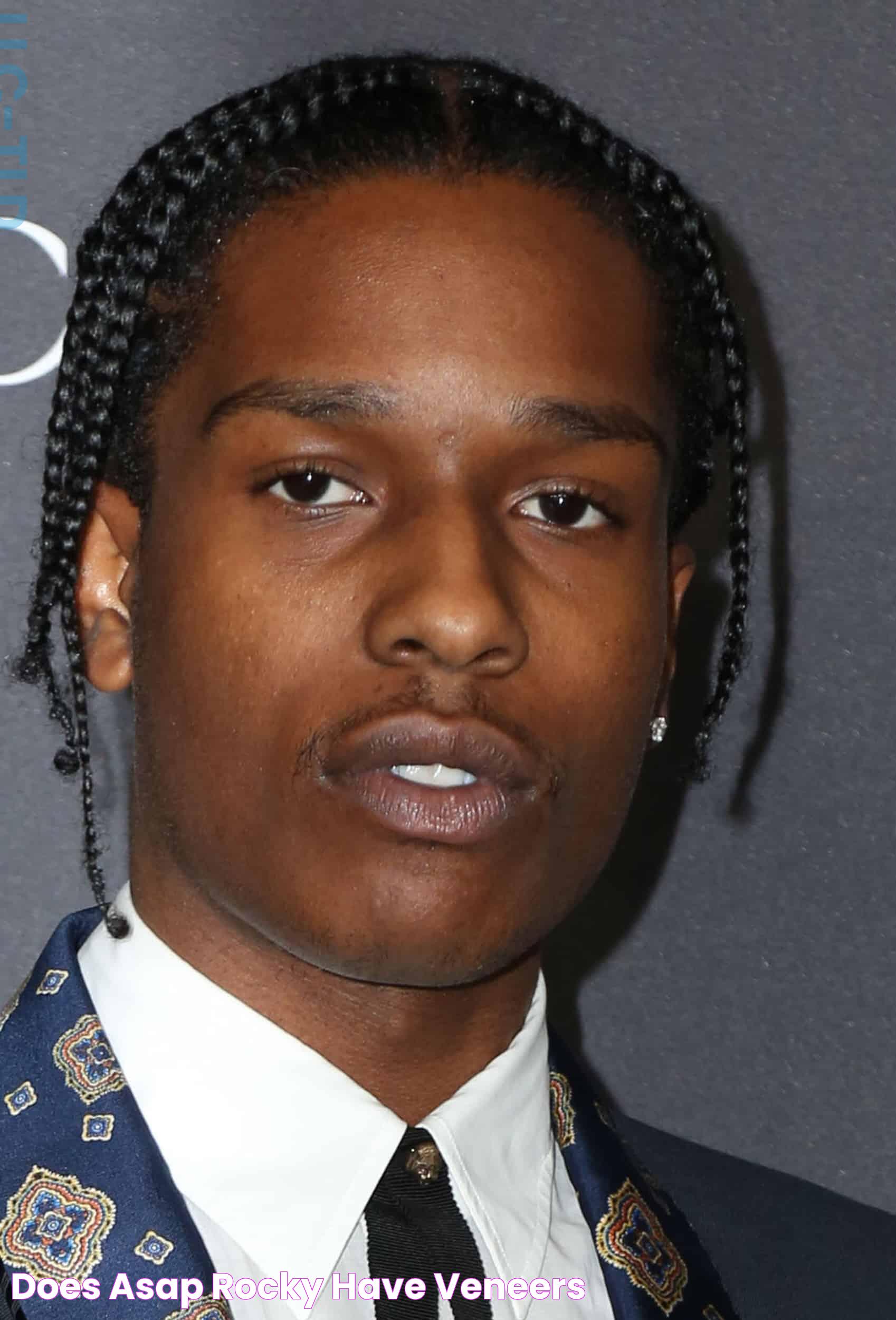 Does ASAP Rocky Have Veneers?