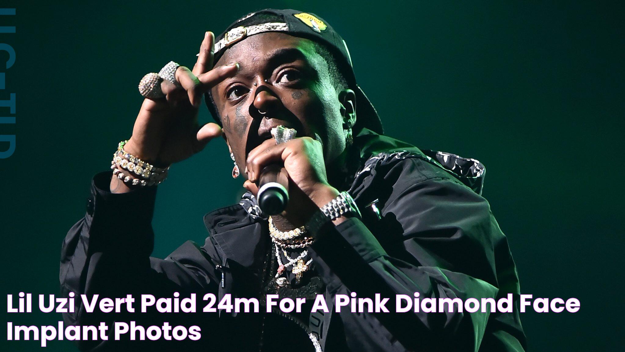 Lil Uzi Vert Paid 24M for a Pink Diamond Face Implant [PHOTOS]