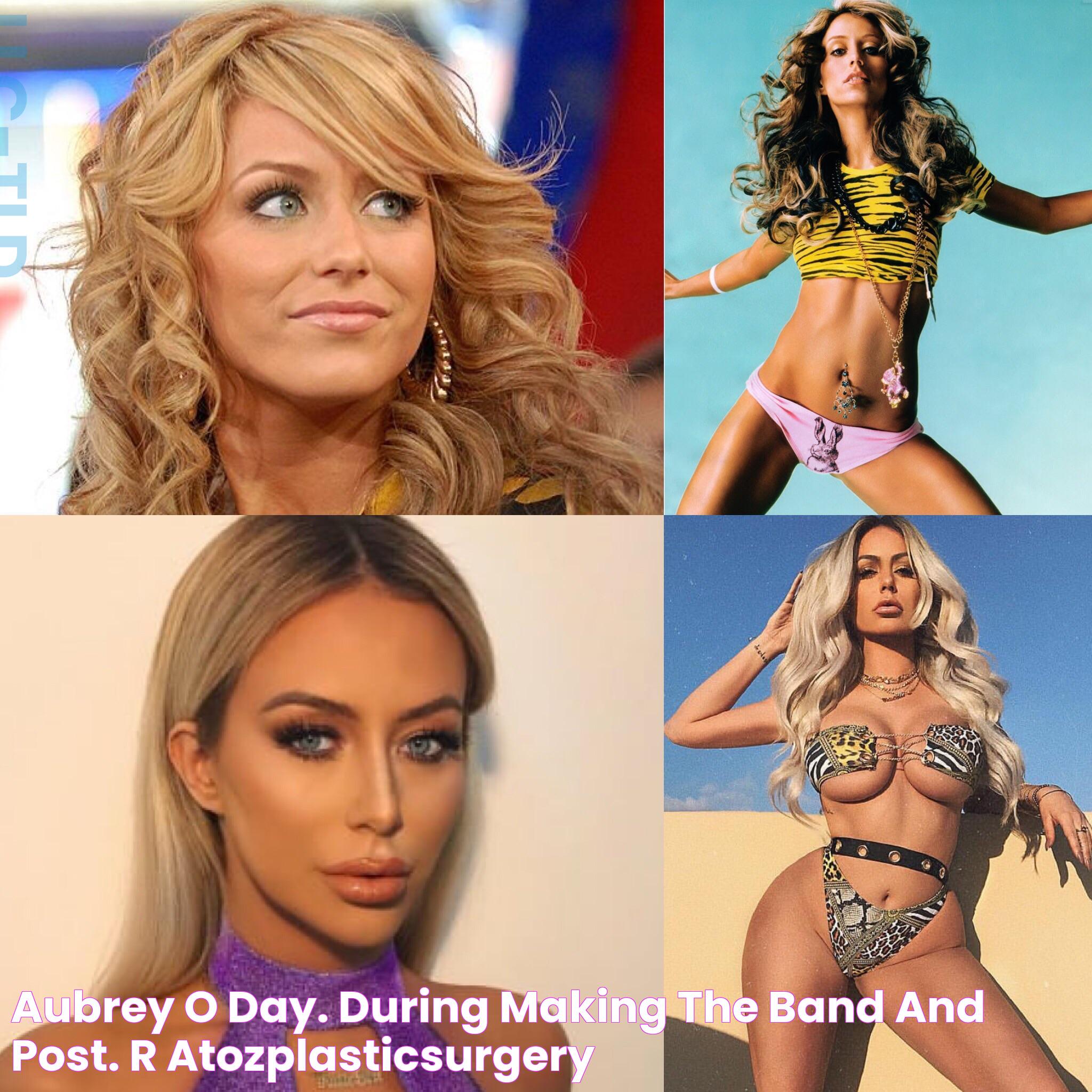 Aubrey O’Day. During “Making the Band” and post. r/AtoZplasticsurgery