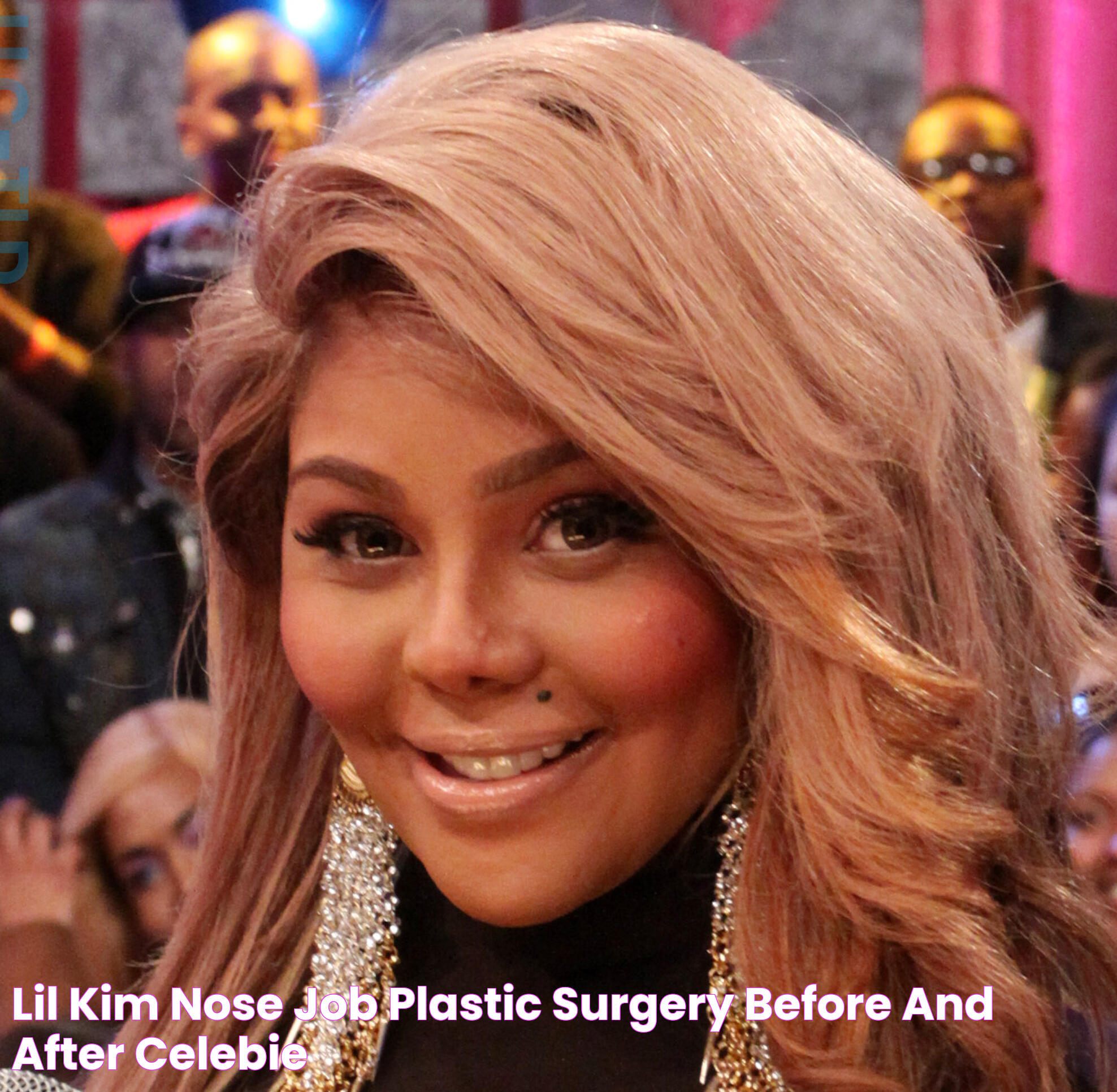 Lil Kim's Transformation: Surgery, Style, And Impact