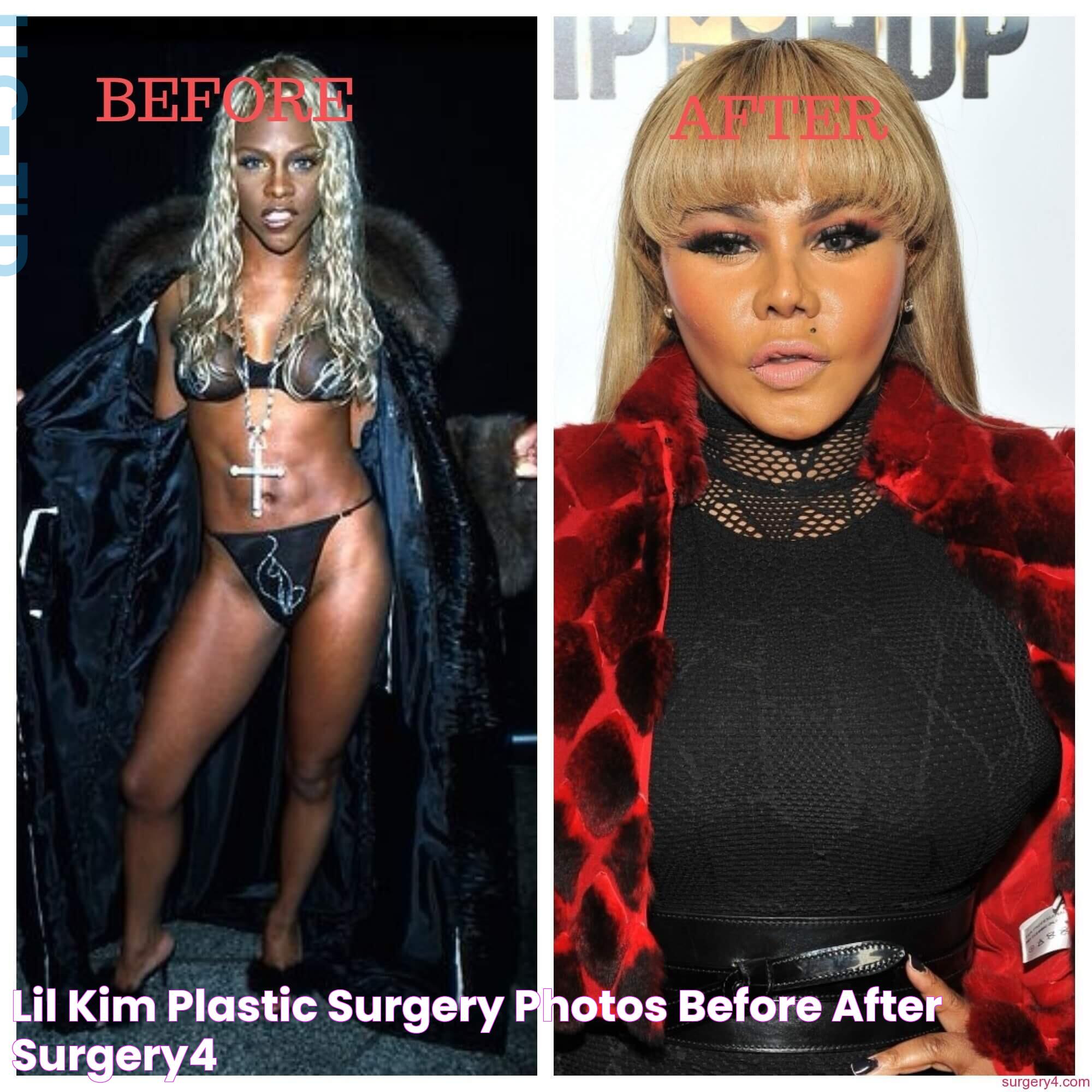 Lil Kim Plastic Surgery Photos [Before & After] Surgery4